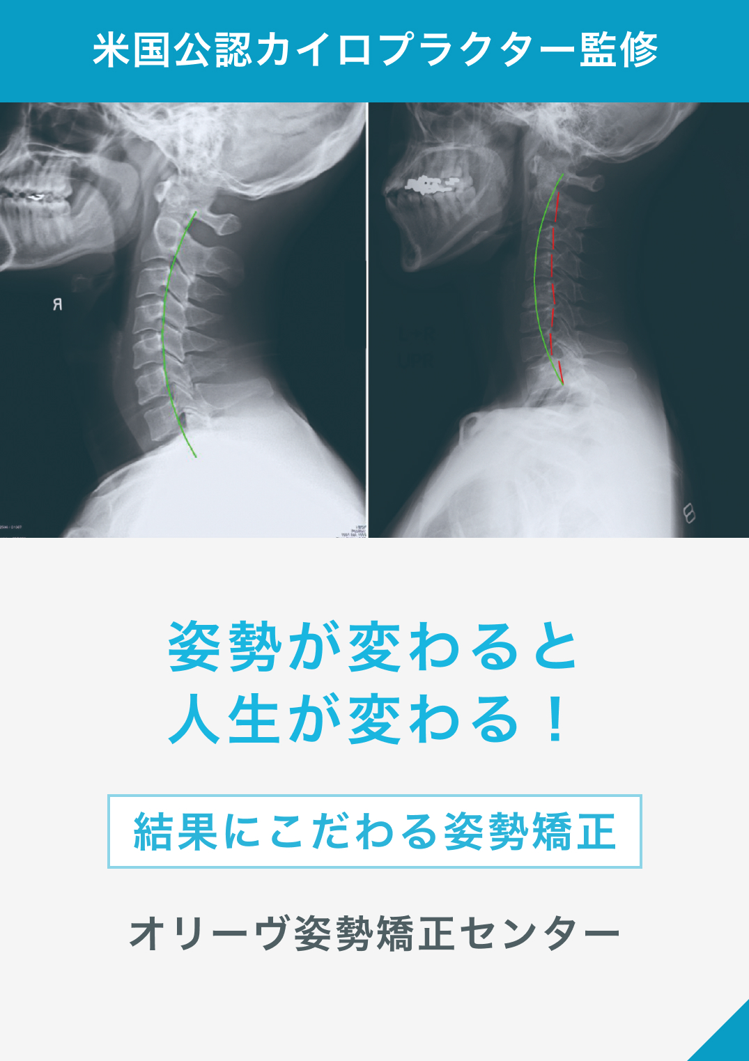 オリーヴ姿勢矯正センター | 米国公認の姿勢改善のプロと 施術実績７万人超の身体のプロの コラボで生まれた姿勢矯正